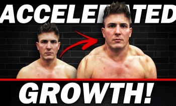 3 Mistakes Holding Back Your Trap Growth! FIX NOW!